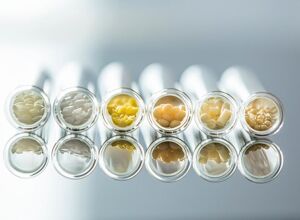 Völpker: Wachs für individuelle Aufgaben