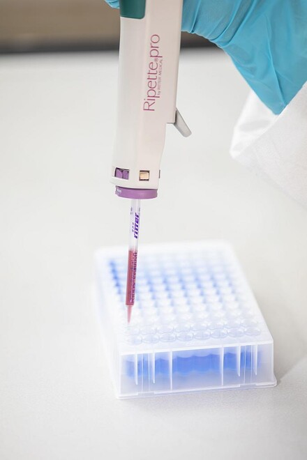 Mit einer Ripette werden Blutproben in die Mikrotiterplatten gegeben, um Corona-Schnelltests durchzuführen. (Foto: Matthias Baumgartner Videofotografie)