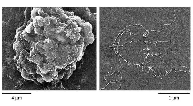 Elektronenmikroskopische Aufnahmen von Kohlenstoff-Nanoröhren (CNTs) im agglomerierten (links) und dispergierten Zustand (rechts). (Foto: Lanxess)