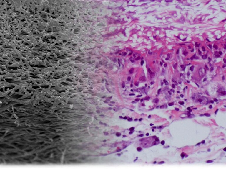 Das künstliche Material (l.) und das Biomaterial (r.) lassen sich gut kombinieren. (Foto: MedUni Wien)